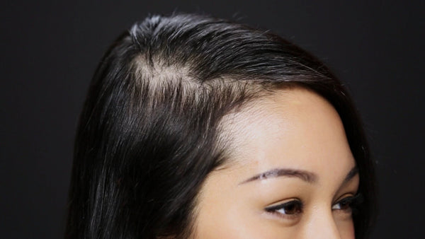 Foto prima dell'applicazione di TOPPIK su capelli donna