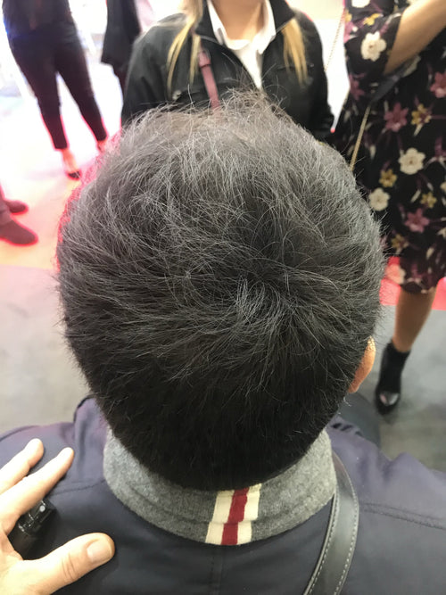 Foto dopo di applicare TOPPIK su capelli uomo