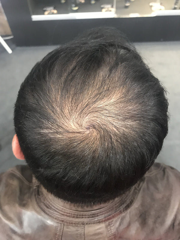 Foto prima dell'applicazione di TOPPIK su capelli uomo