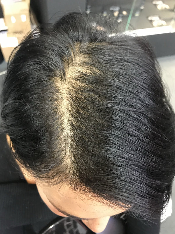 Foto prima dell'applicazione di fibre di cheratina su capelli donna