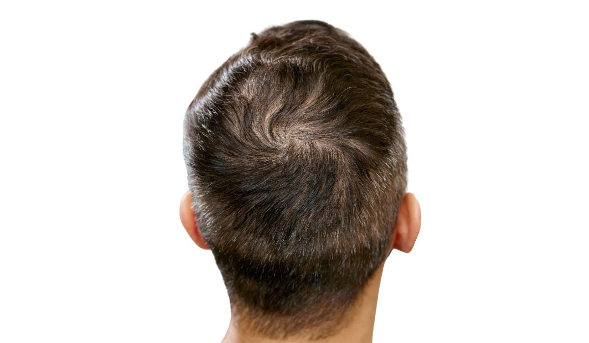 capelli prima dell'uso delle fibre di cheratina